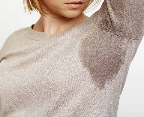 Excessive Sweating Treatment