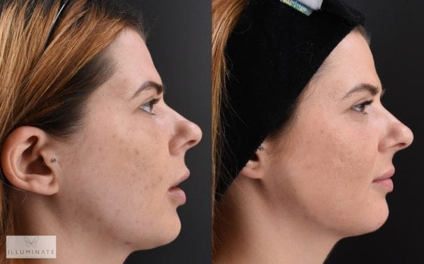 “How Dr Sophie transformed my skin and self-confidence”, by Illuminate team member Emma Nye.