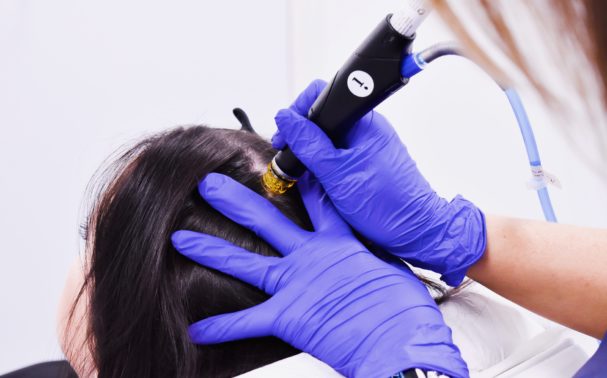 Everything You Need to Know About Female Pattern Hair Loss—Including How to Treat It