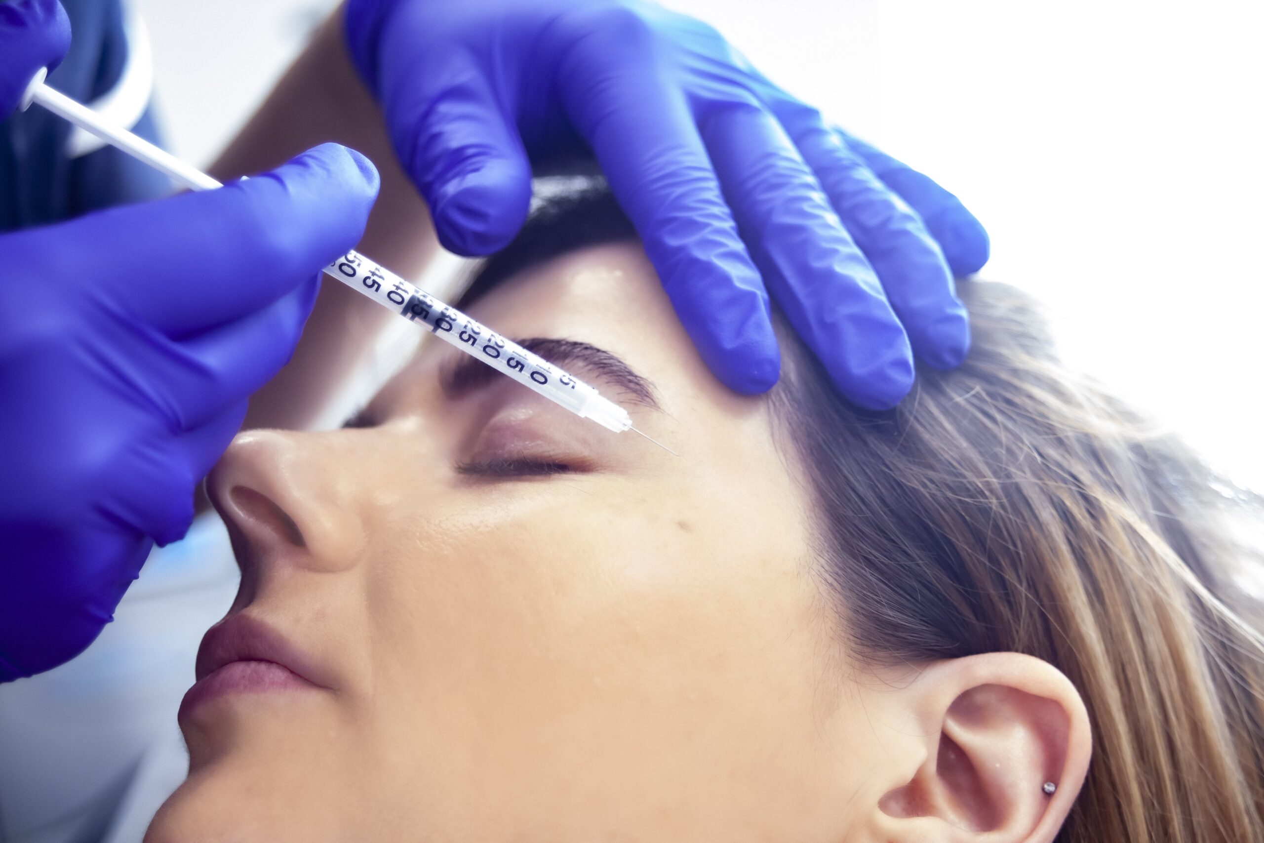 How many areas of Botox will I need?