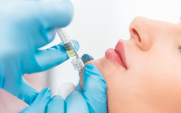 Juvederm Volux – A new era of chin and jawline sculpting