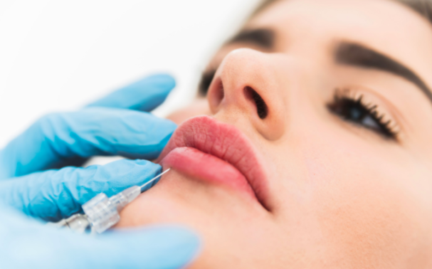 How to make your lip filler results last longer
