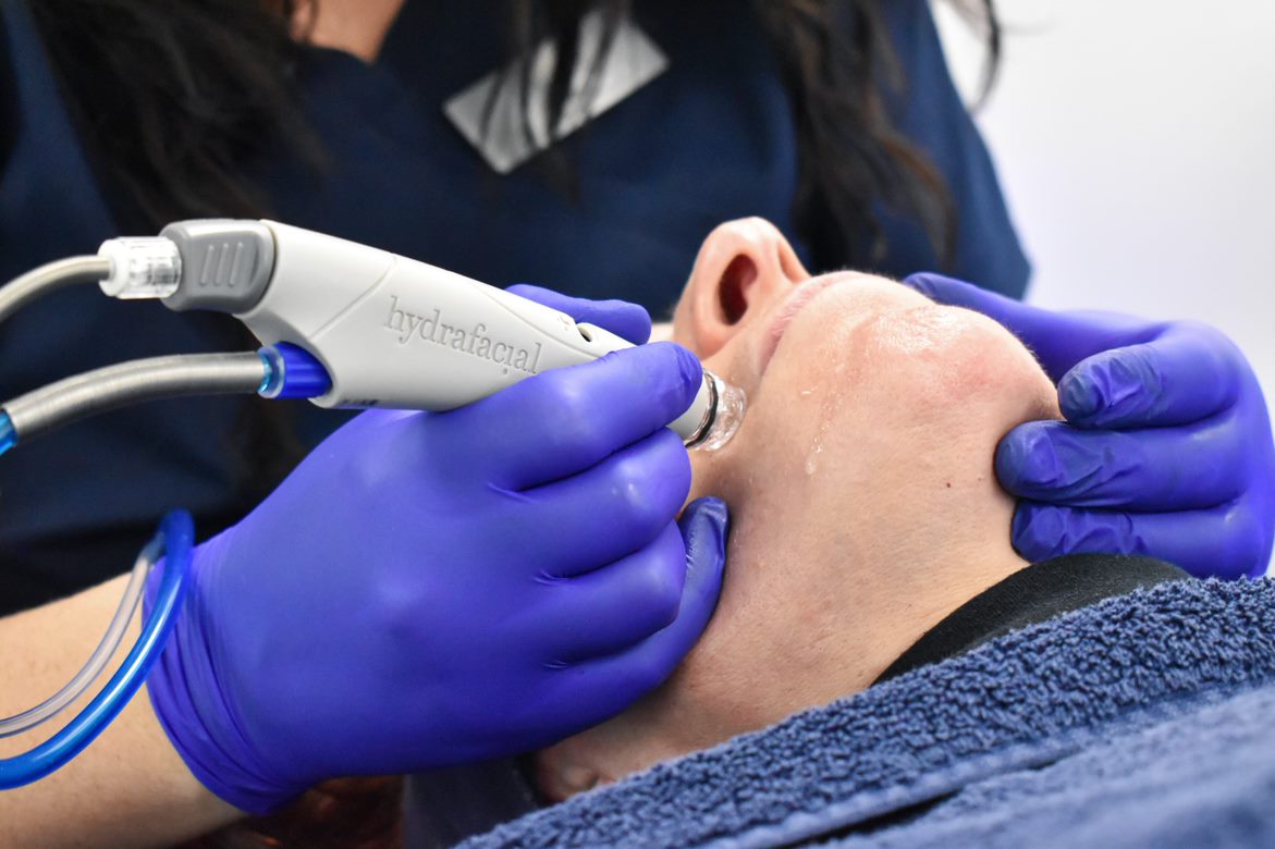 HydraFacial vs Microdermabrasion – Which is best for me?