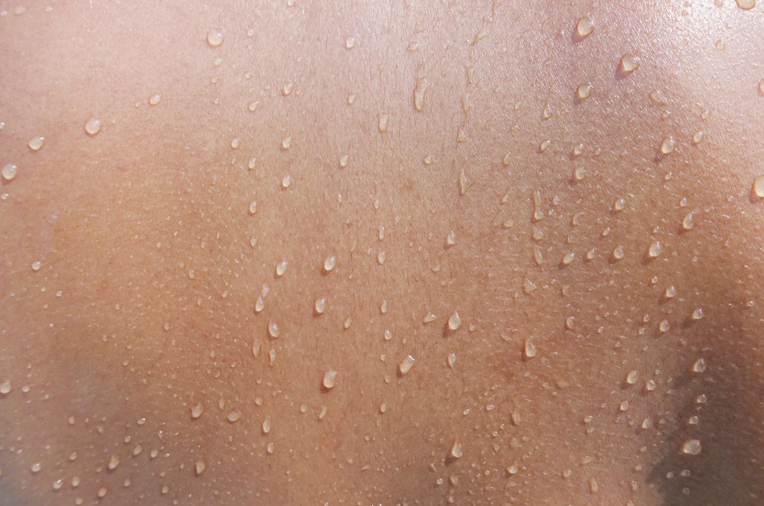 How Can I Prevent Excessive Sweating?