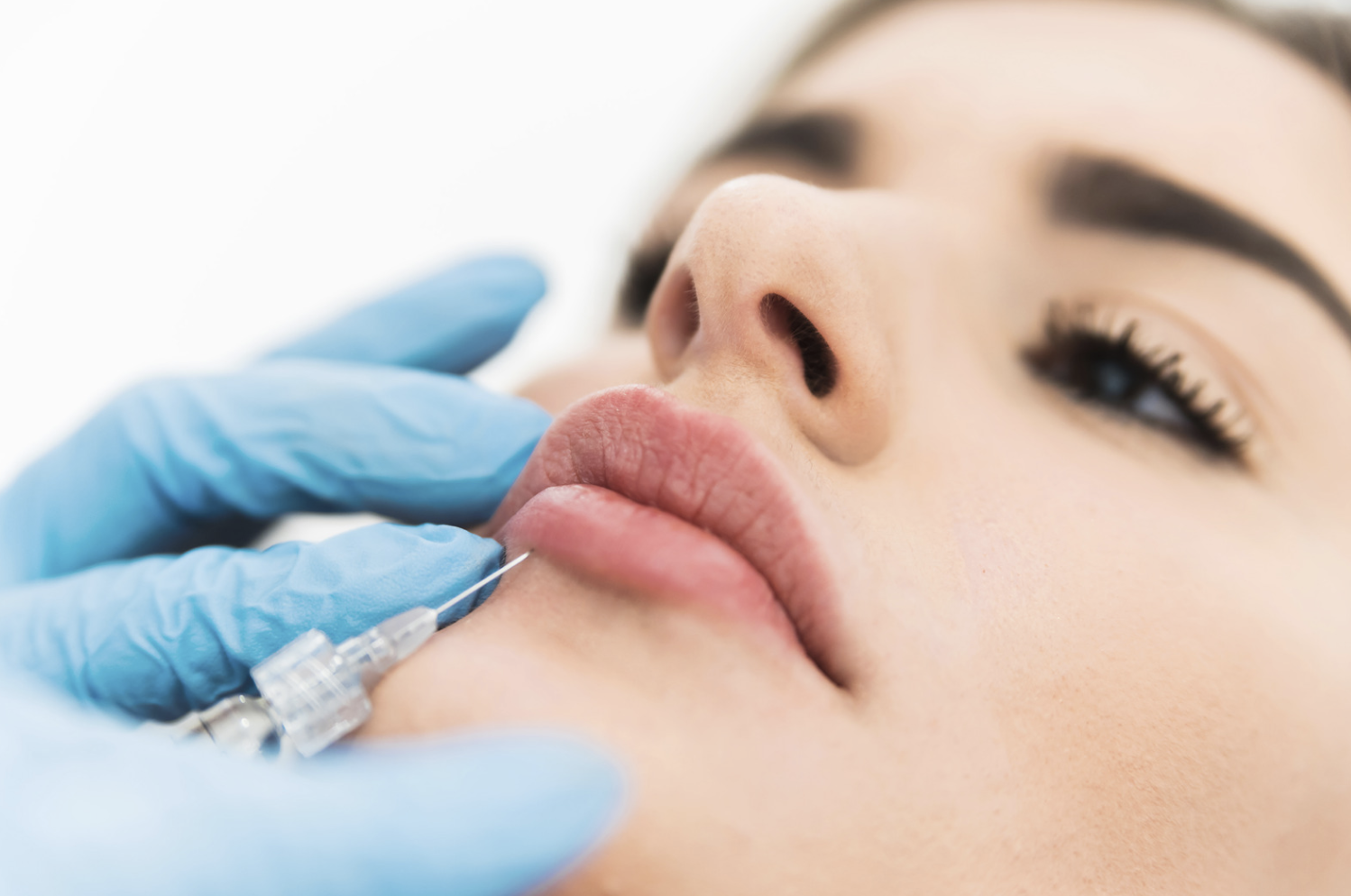 Lips fillers: How long do they last? How much do they cost? This is everything you need to know