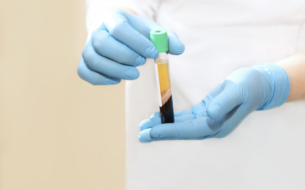 What is Platelet Rich Plasma and how does it work?