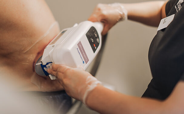 Can CoolSculpting reduce man boobs (pseudogynecomastia)?