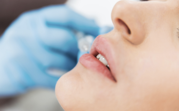 Dermal Fillers near me – How to find the best dermal fillers clinic in Kent