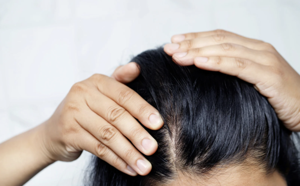 How to treat post-partum hair loss
