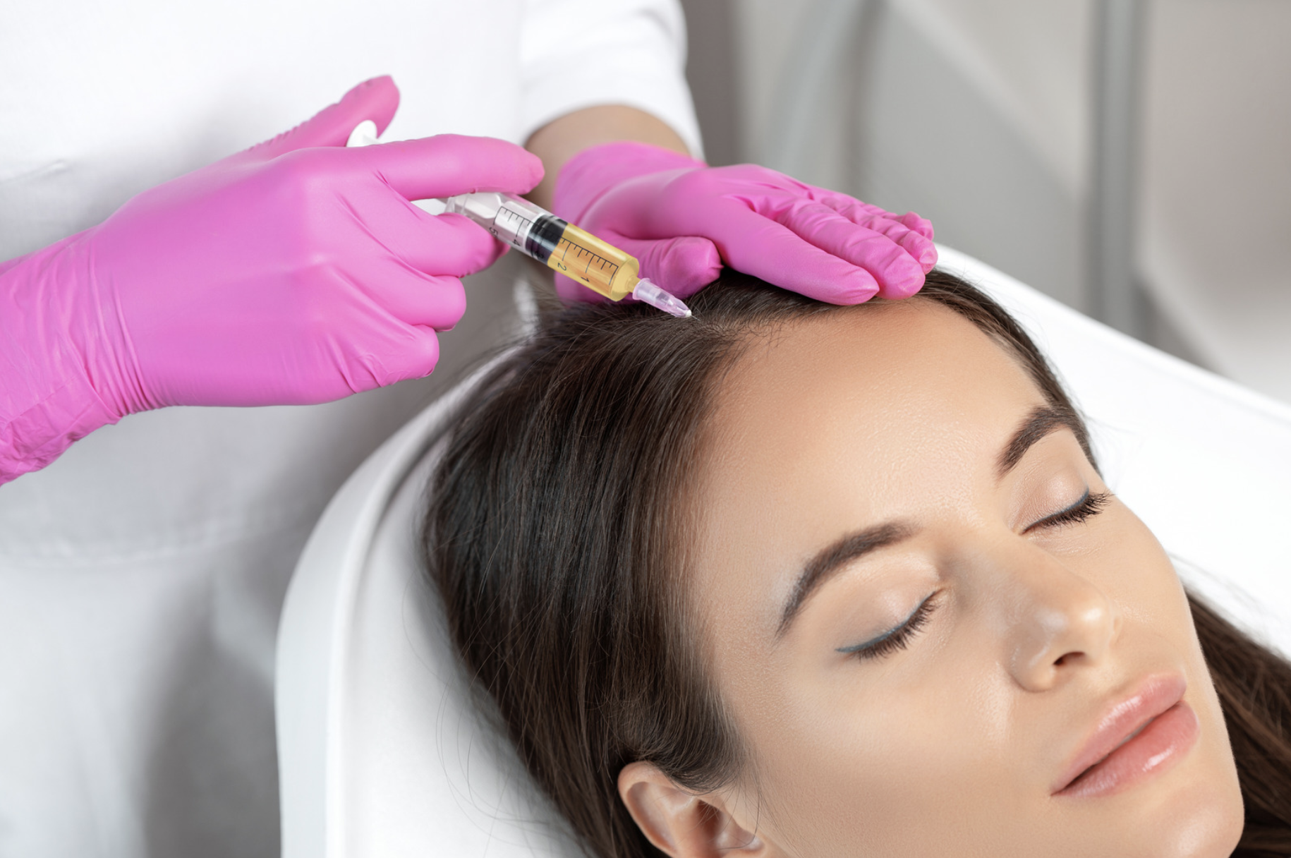 PRP for hair loss: Does it work?