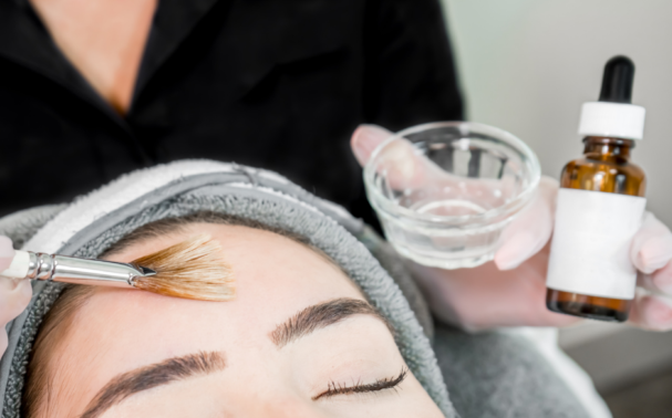 Which skin peel is right for me?