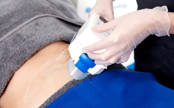 Is CoolSculpting permanent?