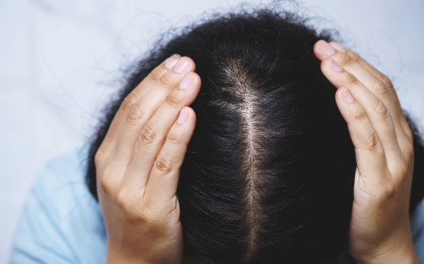 Why is my eyebrow hair falling out? 4 reasons your eyebrows are thinning