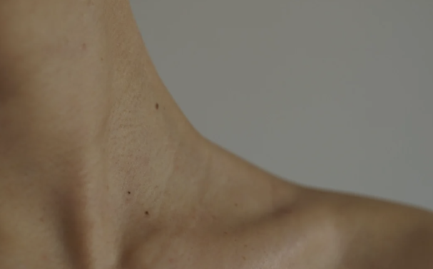 What causes a turkey neck? And how to get rid of it for good