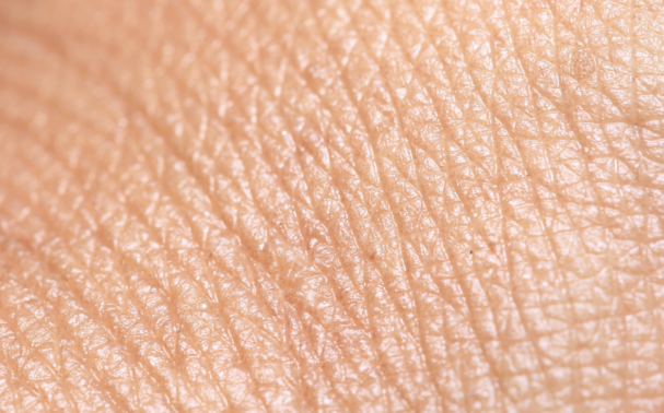 What is crepey skin? And how can it be reversed?