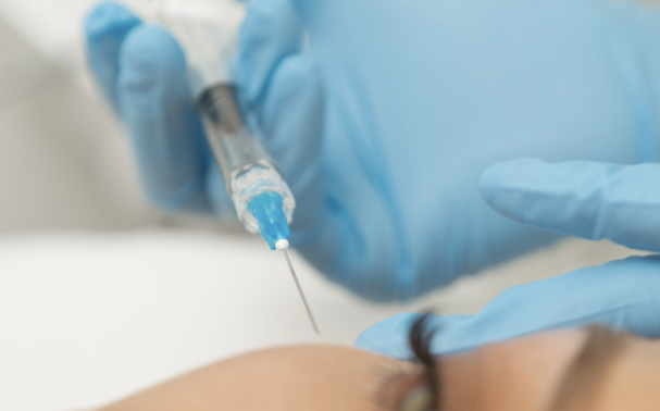 How long do dermal fillers last?