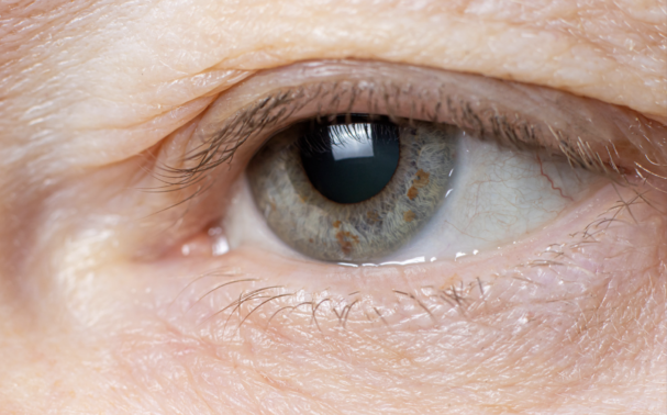 Drooping eyelids: What causes them? And how can you get rid of them?
