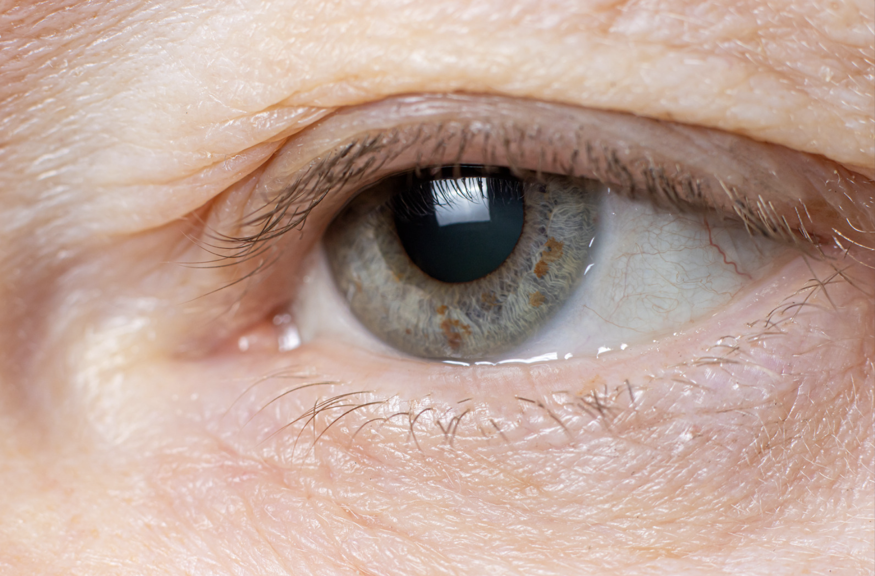 Drooping eyelids: What causes them? And how can you get rid of them?