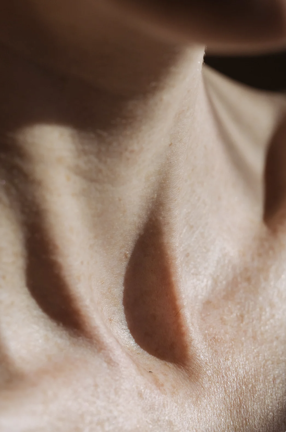 How to treat neck lines and wrinkles