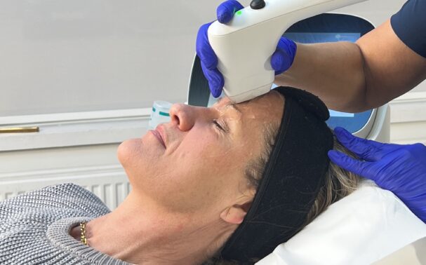 Is it possible to lift the brow non-surgically?