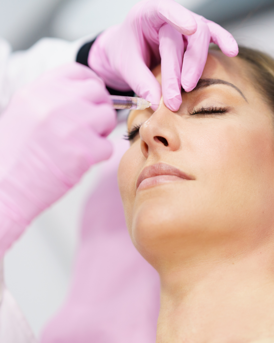 How to balance and improve your side profile with fillers