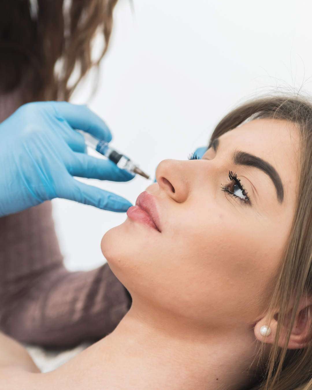 HArmonyCa vs Profhilo: Which is right for you?