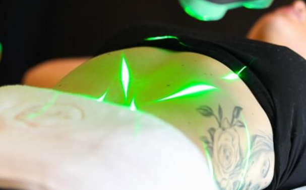 Emerald Laser vs CoolSculpting: Which is Right for You?
