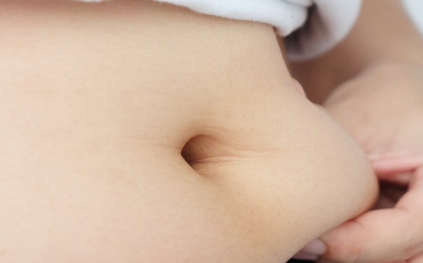 What is the best non-surgical cosmetic procedure to get rid of fat?