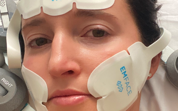 EmFace vs Morpheus8: Which is right for you?