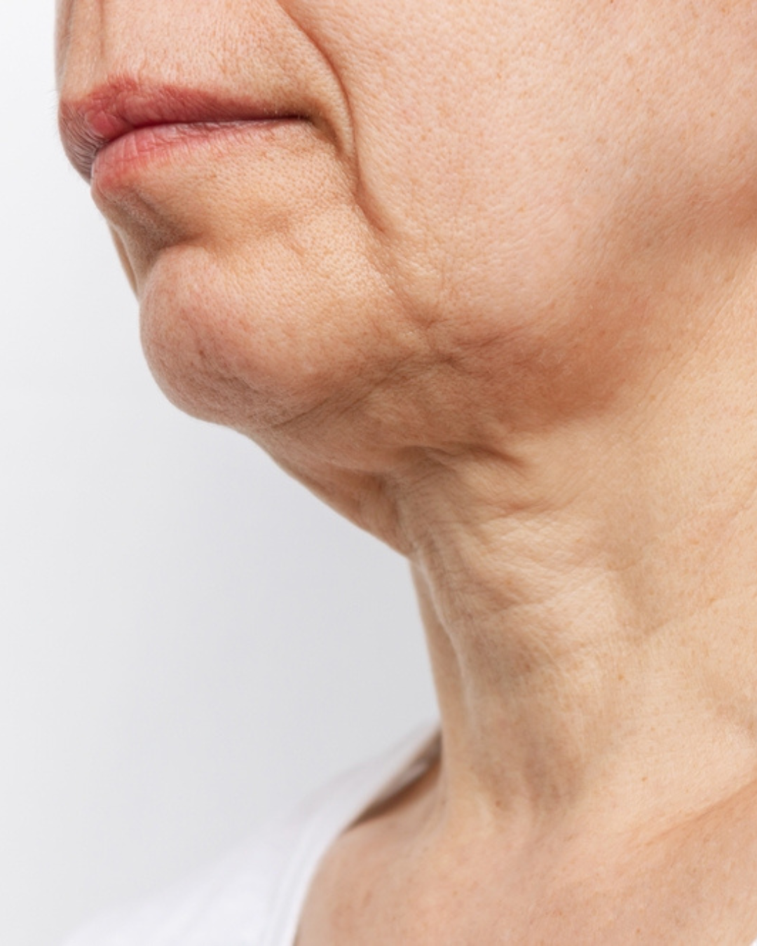 How to fix a crepey neck